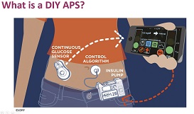 What is DIY-APS?